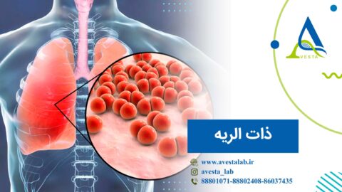 ذات الریه یا پنومونی