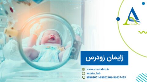 زایمان زودرس