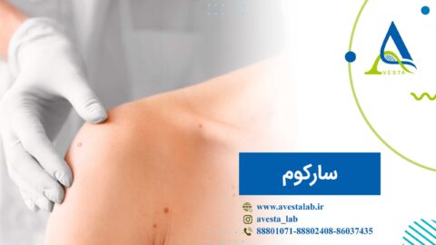 سارکوم