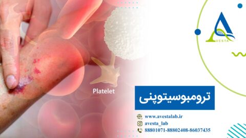 ترومبوسیتوپنی