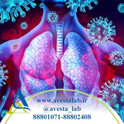 سیستم ایمنی ضعیف