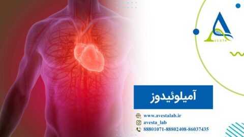 آمیلوئیدوز