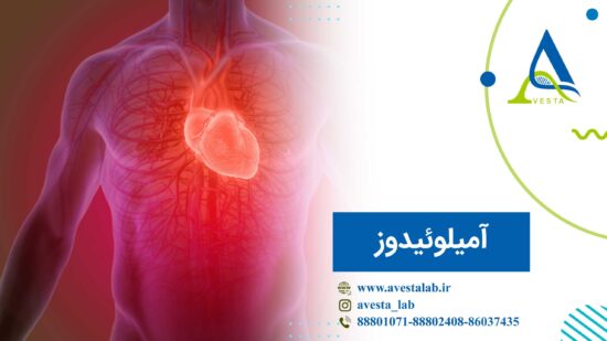 آمیلوئیدوز
