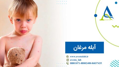 آبله مرغان