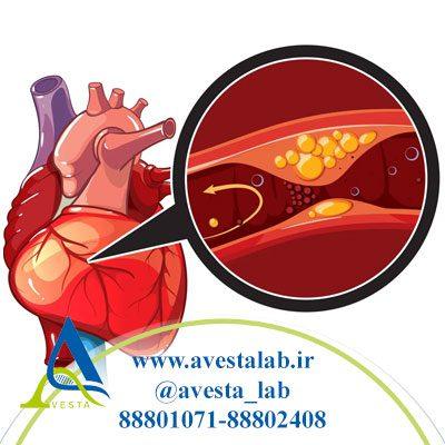 بیماری عروق کرونر CAD