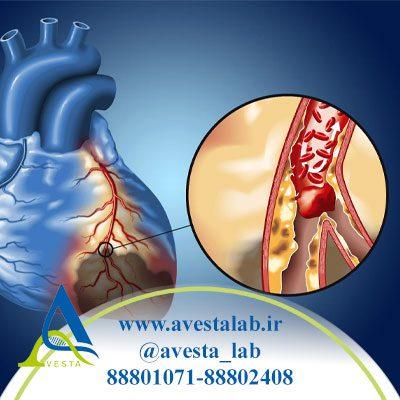 بیماری عروق کرونر CAD
