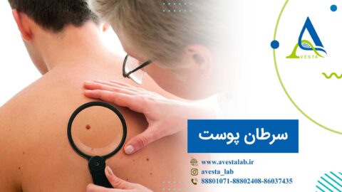 سرطان پوست