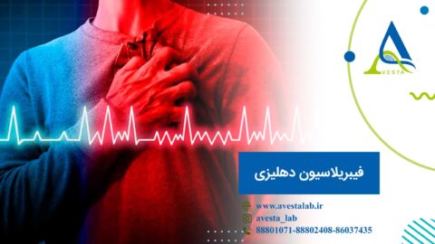 فیبریلاسیون دهلیزی
