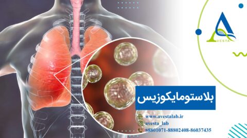 بلاستومایکوزیس