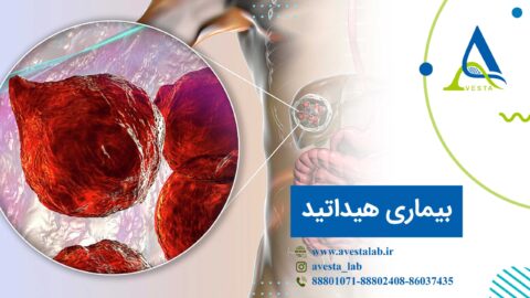 بیماری هیداتید