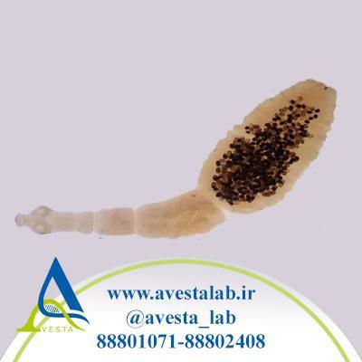 بیماری هیداتید