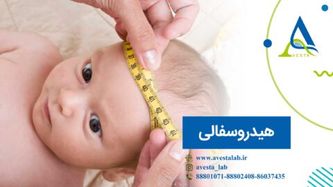 هیدروسفالی