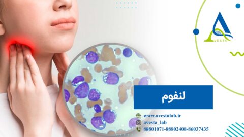 لنفوم