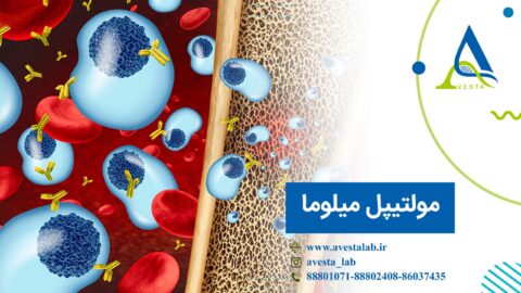 مولتیپل میلوما