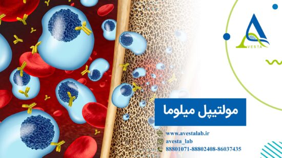 مولتیپل میلوما