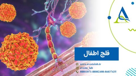 فلج اطفال