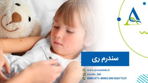 سندرم ری