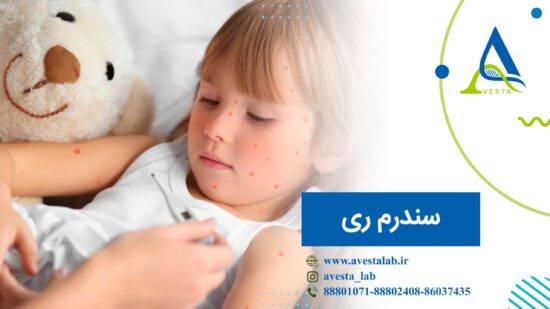 سندرم ری