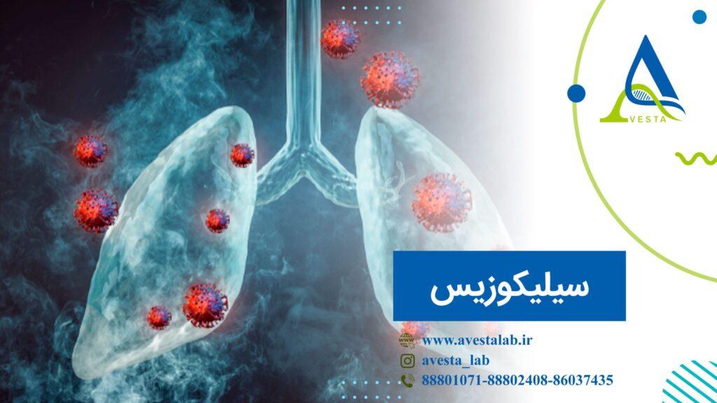 سیلیکوزیس چیست