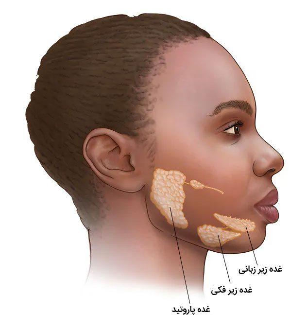 سندرم شوگرن