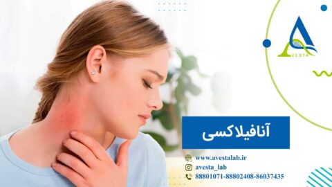 آنافیلاکسی