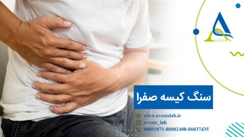 سنگ کیسه صفرا
