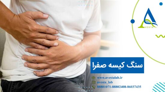 سنگ کیسه صفرا