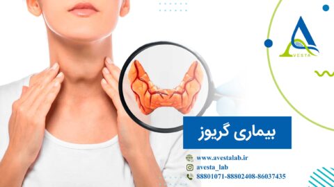 بیماری گریوز