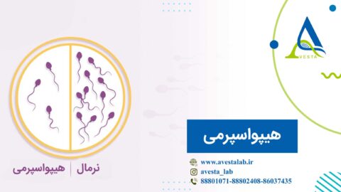 هیپواسپرمی