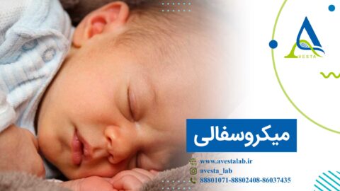 میکروسفالی