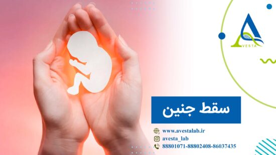 سقط جنین
