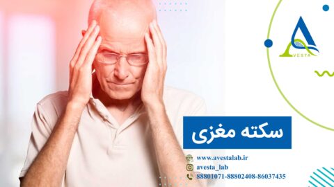 سکته مغزی