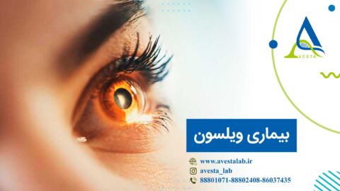 بیماری ویلسون
