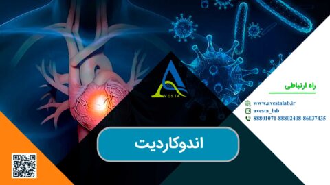 اندوکاردیت