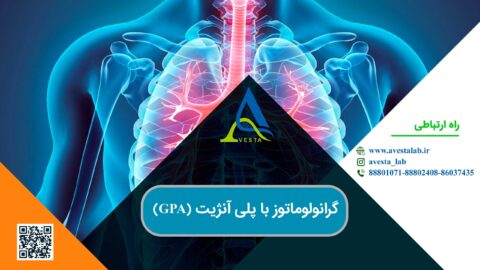 گرانولوماتوز با پلی آنژیت (GPA)