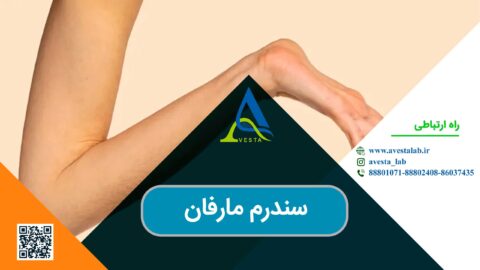 سندرم مارفان (MFS)