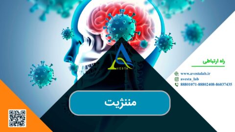 مننژیت