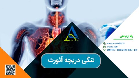 تنگی دریچه آئورت