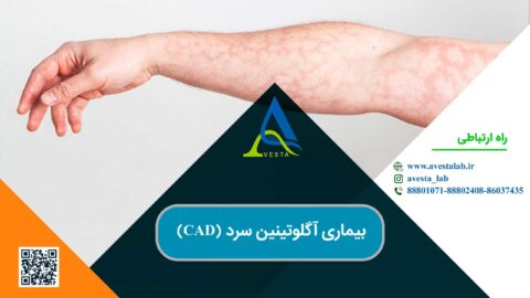 بیماری آگلوتینین سرد (CAD)