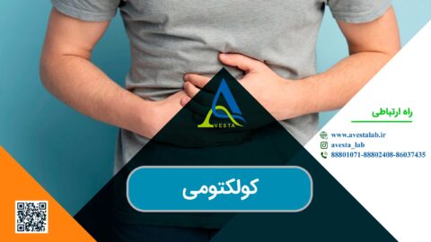 کولکتومی