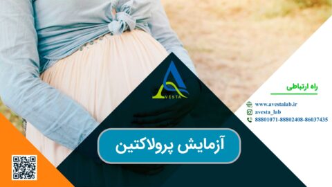 سندرم تخمدان پلی کیستیک (PCOS)