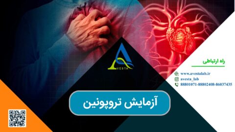 آزمایش تروپونین