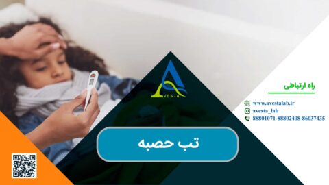تب حصبه