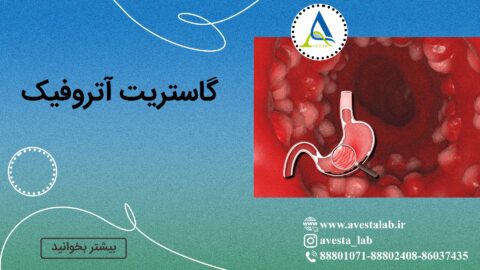 گاستریت آتروفیک