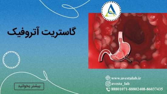گاستریت آتروفیک
