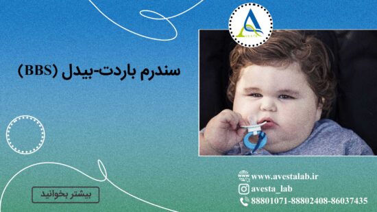 سندرم باردت-بیدل (BBS)