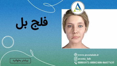 فلج بل چیست؟