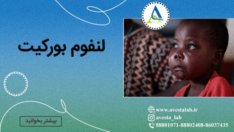 لنفوم بورکیت