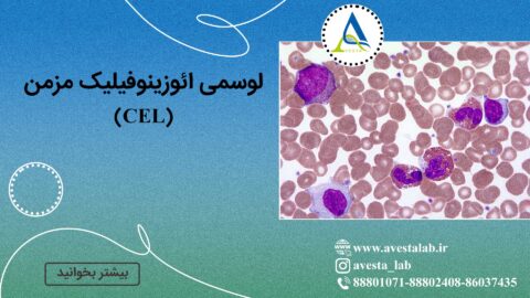 لوسمی ائوزینوفیلیک مزمن (CEL)