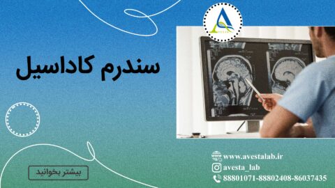سندرم کاداسیل